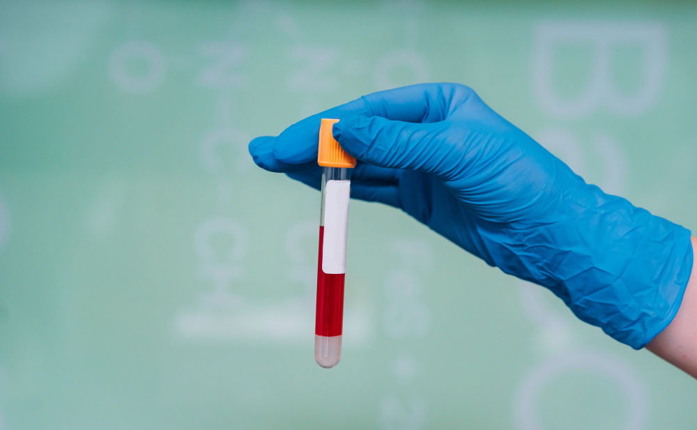 Blood Tests Decoded: What Do Your Reports Really Mean?