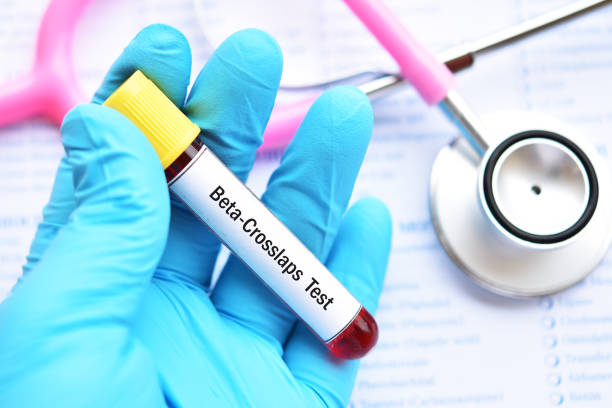 Beyond the Bones - Exploring the Beta Cross Laps Test for Assessing Bone Resorption