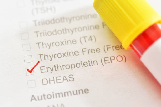 The importance of active EPO