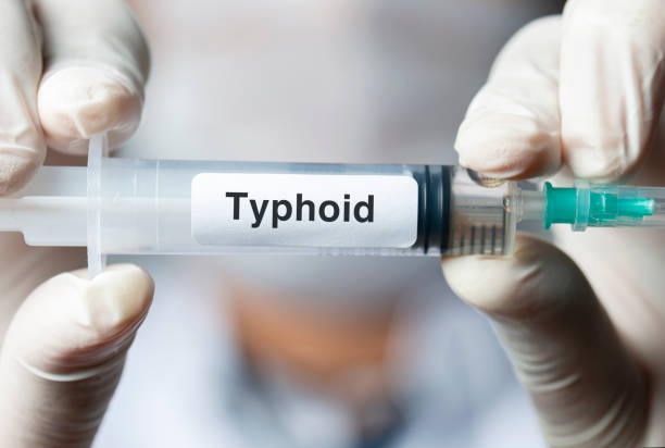 The vital role of early detection in managing Typhoid