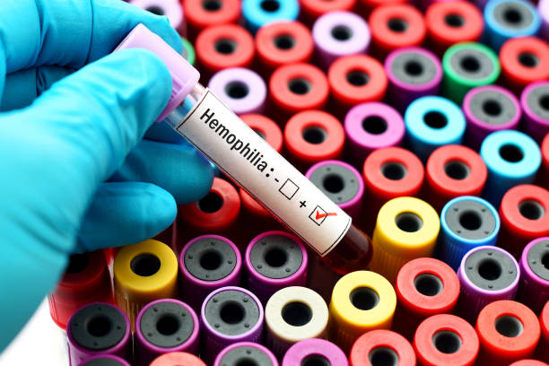 All You Need To Know About Haemophilia